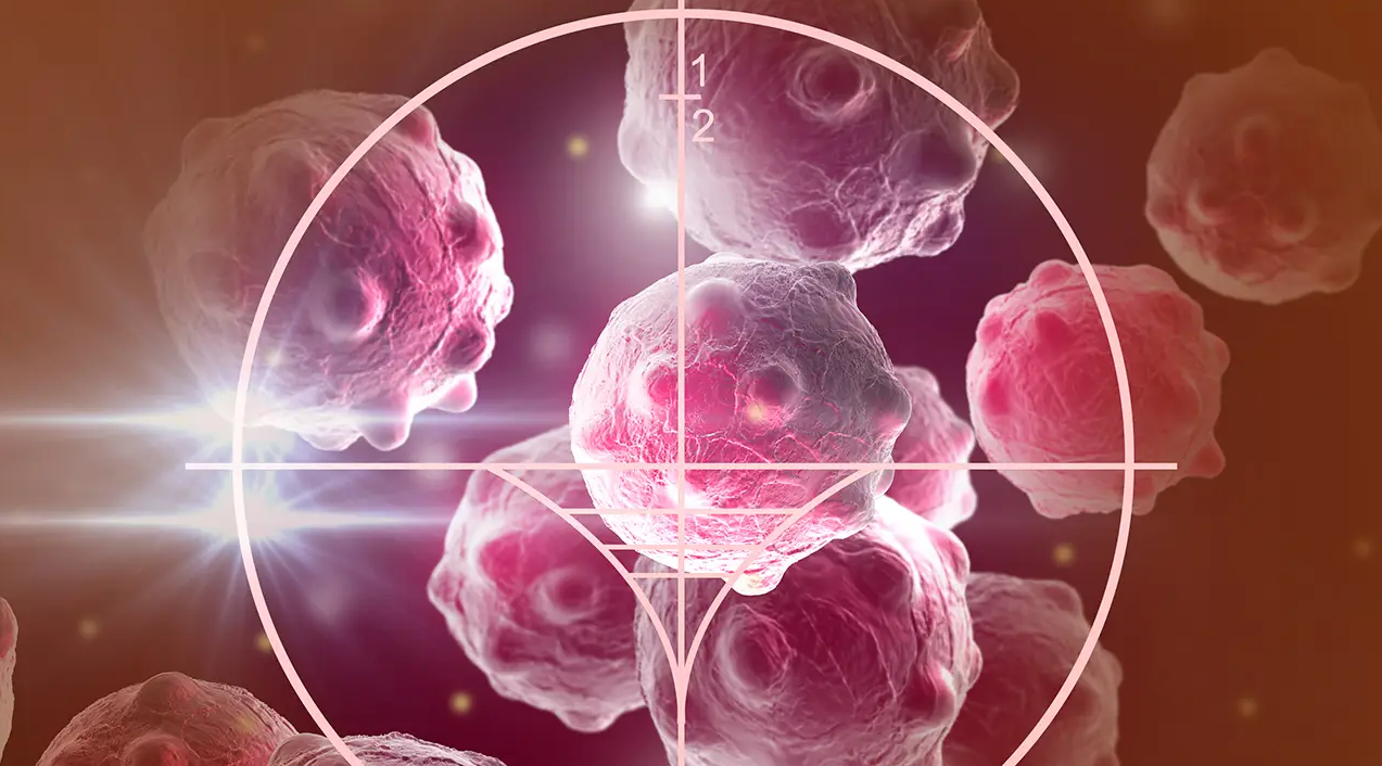 文献解读|Genome Med（12.3）：乳腺癌的基因组和转录组分析确定了与新