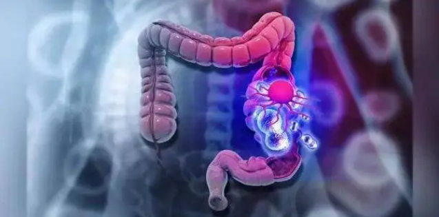 文献解读|Cell（64.5）：分子制图揭示散发性结直肠肿瘤的进化和微环境动态