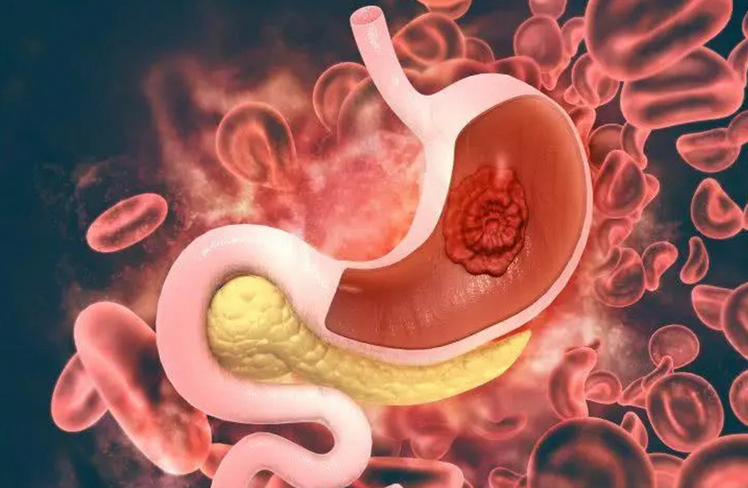 文献解读|Cell Rep Med（11.7）：利用患者来源的类器官进行个性化药