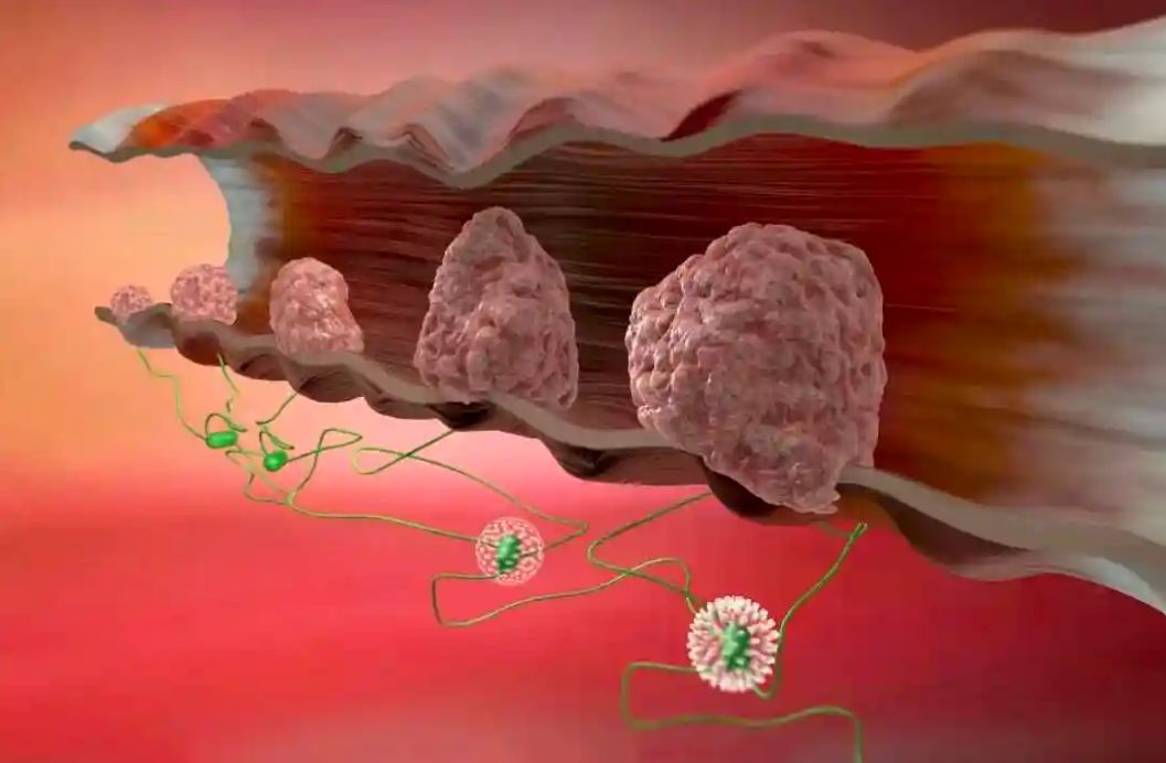 文献解读|Cell Rep（8.8）：原发性结直肠癌和转移进展的蛋白质组学特征确