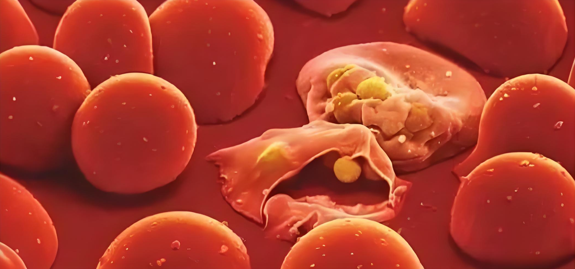 文献解读|Nat Commun（16.6）：患重症疟疾贫血儿童的外周血转录组研究