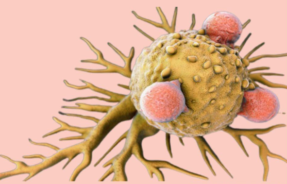 文献解读|Nat Cancer（23.5）：单细胞转录组图揭示嗅神经母细胞瘤亚型