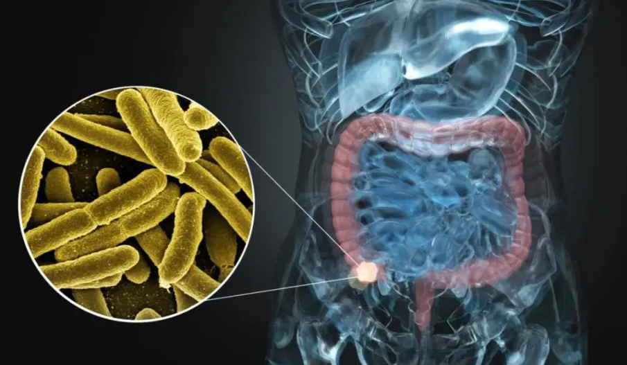 文献解读|Cancer Cell（48.3）：组成型干扰素高免疫表型决定了结直肠