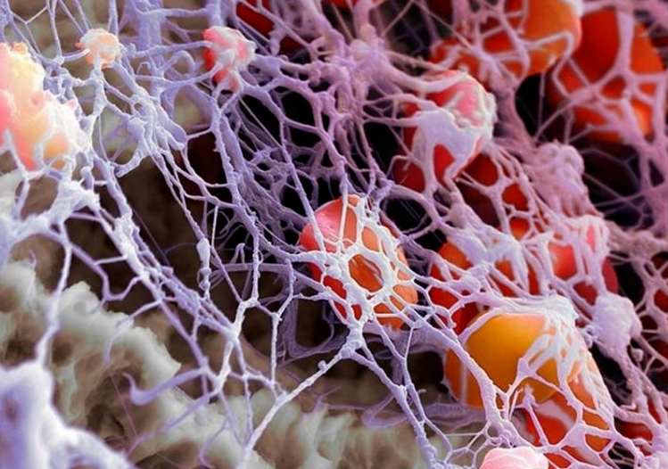 文献解读|Nat Genet（31.7）：儿童和青少年血浆蛋白质组变异及其遗传决