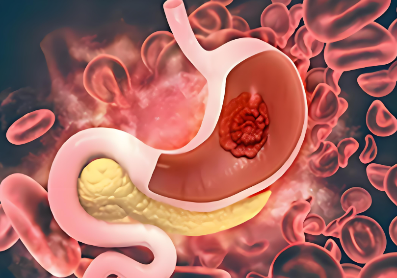文献解读|Cancer Discov（29.7）：空间分析肿瘤生态系统和细胞状态