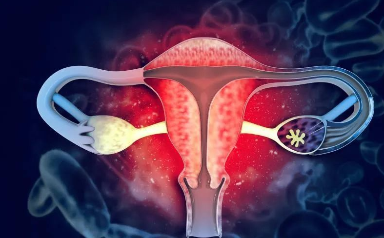 文献解读|Nat Commun（14.7）：免疫疗法可改善高级别浆液性卵巢癌的化