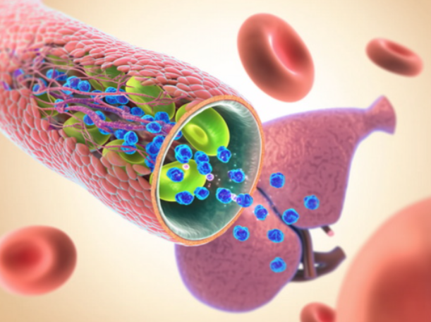 文献解读|Clin Mol Hepatol（16.9）：肝内胆管癌的放射基因组学