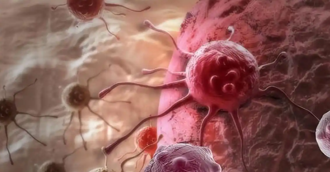 文献解读|J Hepatol（33）：从乳头状肿瘤到胆道癌的连续致癌性的基因组和