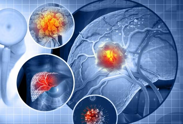 文献解读|Nat Med（50）：接受猪肝异种移植的人类死者的免疫细胞景观