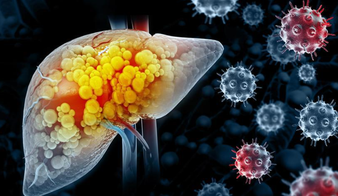 文献解读|Nat Commun（14.7）：多组学分析揭示肝细胞癌肝移植接受者存