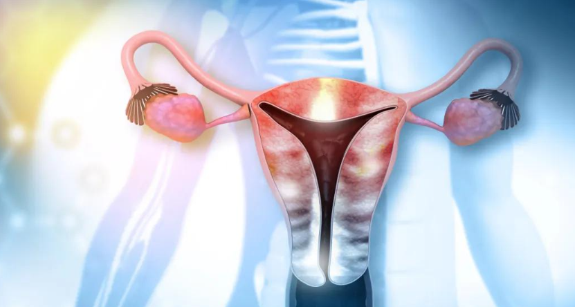 文献解读|Clin Cancer Res（10.2）：同步性子宫内膜样癌和卵巢癌