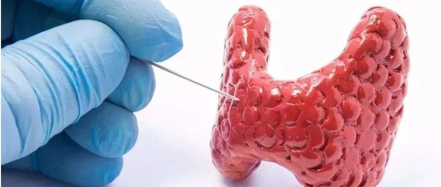 自噬（13.391）：甲状腺激素通过MTOR信号通路介导线粒体自噬并促进线粒体生