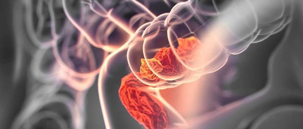 文献解读|Cancers（6.126）：ω-3多不饱和脂肪酸，肠道菌群，微生物代