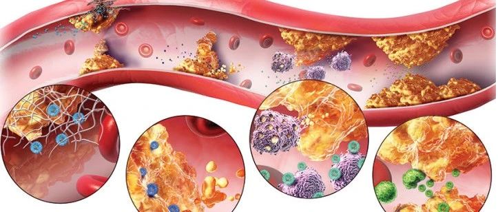 文献解读|Sci Transl Med（19.31）：饮食诱导的肥胖通过损害真皮