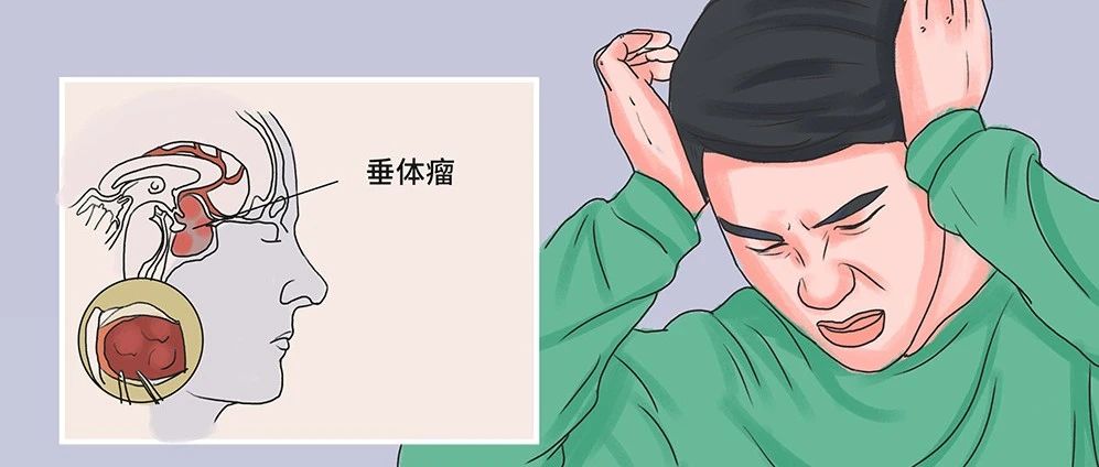 文献解读|Cell Res(46.297): 垂体神经内分泌肿瘤主要组织类型的蛋