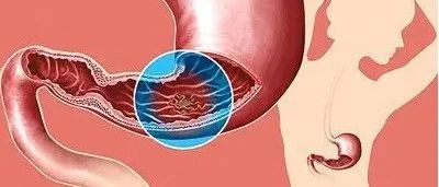 文献解读|J Allergy Clin Immunol（14.29）：常见变异性