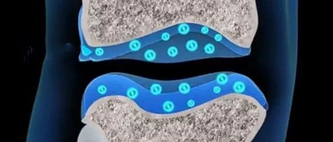 文献解读|（10.750）：软骨中XBP1缺失对LncRNA/CircRNA-m