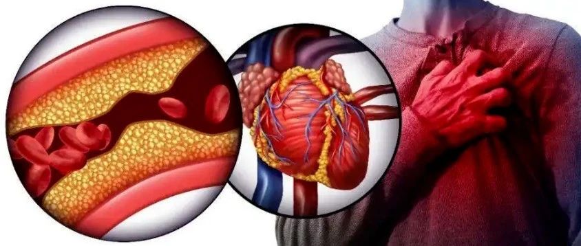 文献解读|Circ Res（23.213）：组蛋白乳酸化修饰促进心肌梗死后修复基